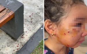 Criança de três anos é atacada por cães