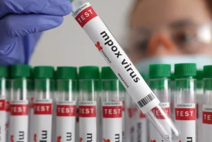 Argentina descarta mpox em tripulante de navio que saiu do Brasil