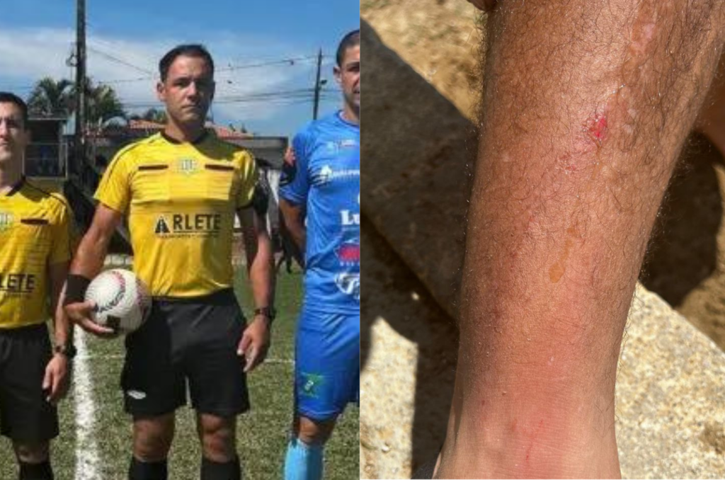 Árbitro é agredido com socos e chutes em liga amadora de Tubarão