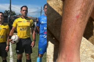 Árbitro é agredido com socos e chutes em liga amadora de Tubarão