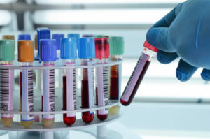 Comissão promove debate sobre atenção à saúde das pessoas com talassemia