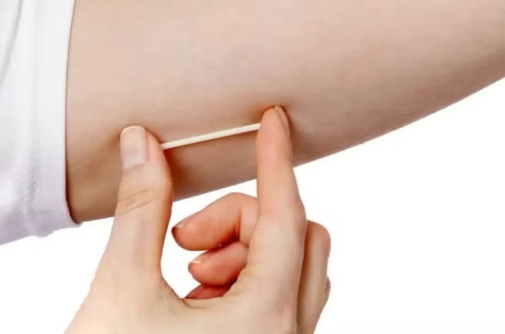 ‘Paciente ficou careca e outra engordou 15kg’ os efeitos dos ‘chips da beleza’