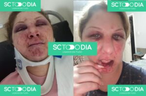 Homem é acusado de agredir ex-companheira em Criciúma