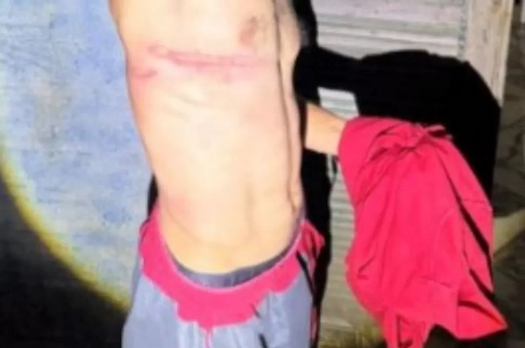 Briga entre irmãos termina em polícia no Turvo