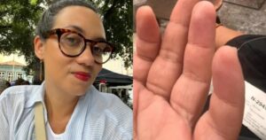 Jornalista é picada por aranha ao escolher alface em feira da capital