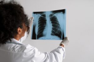 Criciúma reforça ações de combate à tuberculose
