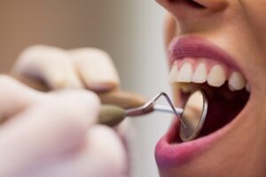 Pacientes iniciam moldagem para próteses dentárias