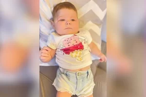 Bebê de Forquilhinha precisa de ajuda para cirurgia