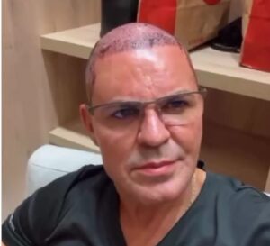 Eduardo Costa surpreende fãs ao aparecer careca