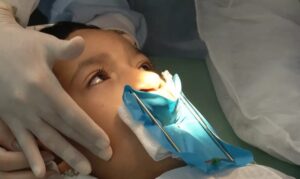 SUS oferecerá cirurgia para lábio leporino