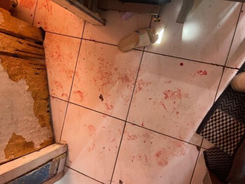 Mulher é presa após briga terminar em hospitalização
