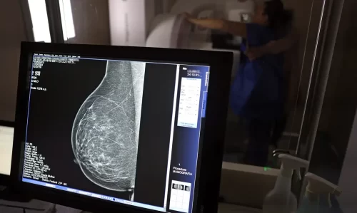 Ministério da Saúde amplia acesso à mamografia pelo SUS a partir dos 40 anos