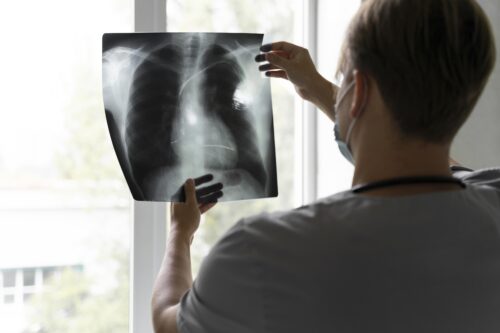 Teste simples pode revelar a idade dos pulmões e prevenir doenças