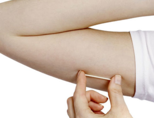 Criciúma passa a oferecer Implanon gratuitamente em todas as unidades de saúde