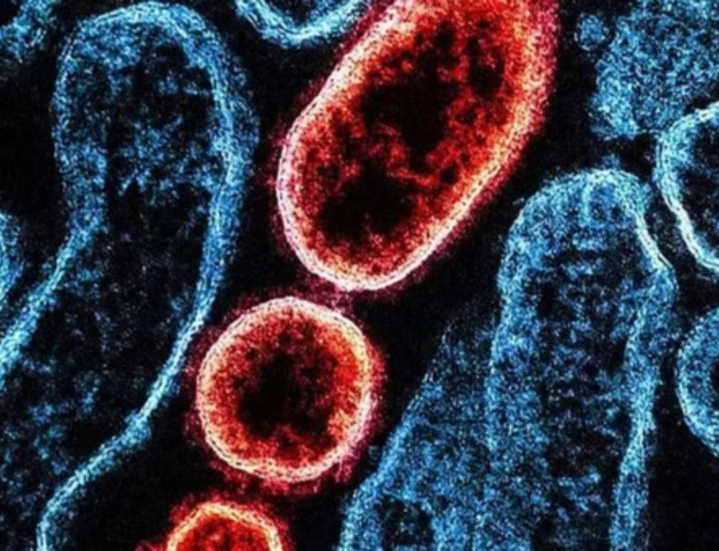 Vírus Nipah preocupa, mas risco de nova pandemia é baixo, apontam especialistas