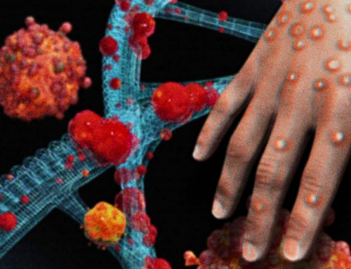 Brasil confirma 90 casos de mpox e amplia alerta