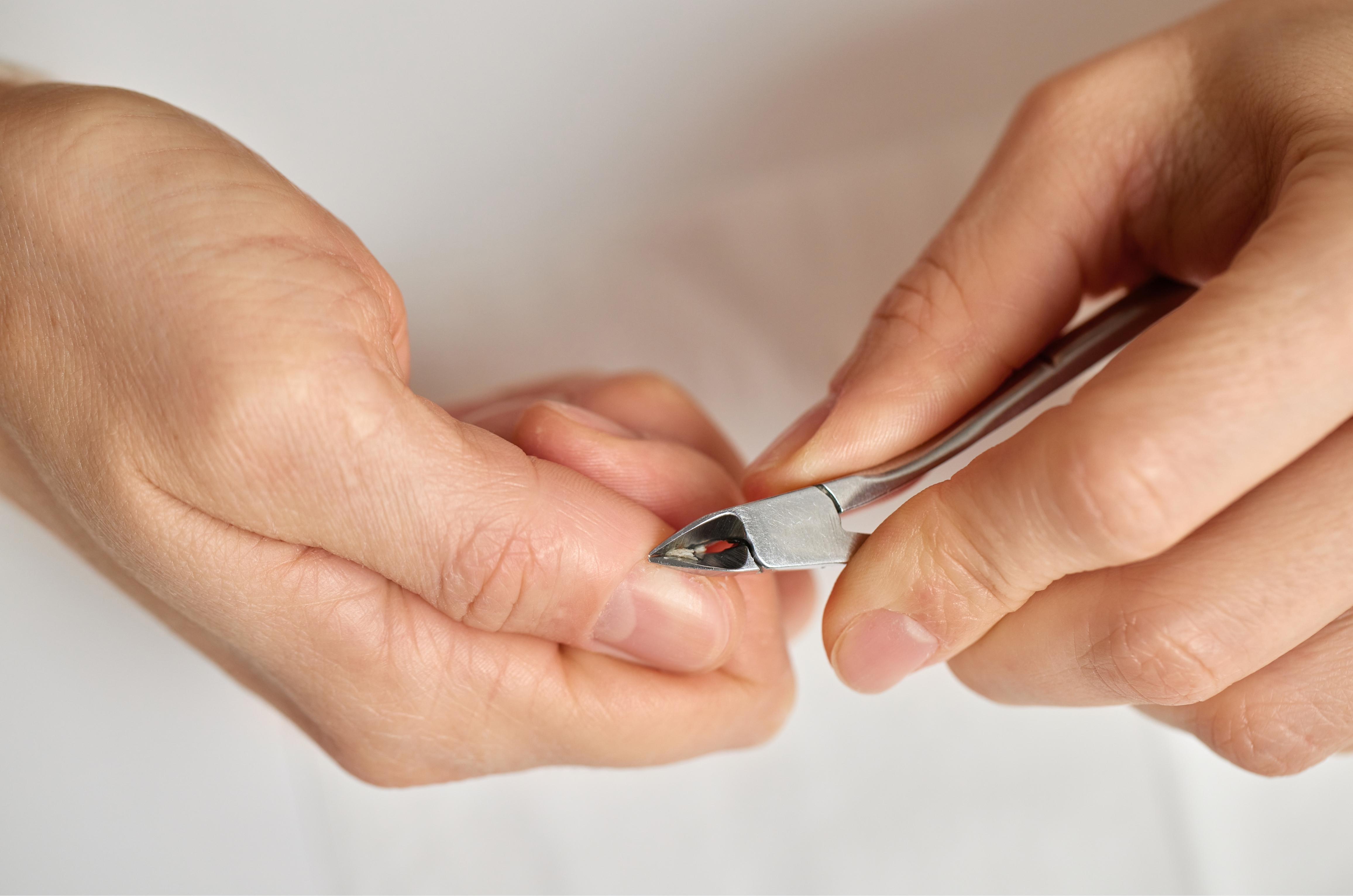 Tirar a cutícula pode causar infecções e danos às unhas, alertam dermatologistas