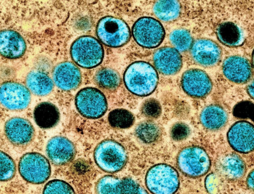 Brasil registra 149 casos de mpox em 2026 e acende alerta