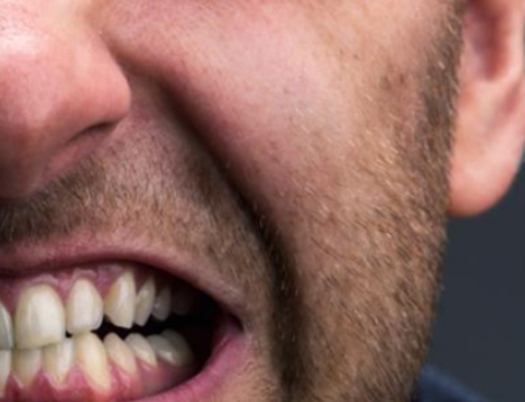 Bruxismo afeta até 40% da população e exige atenção, aponta especialista