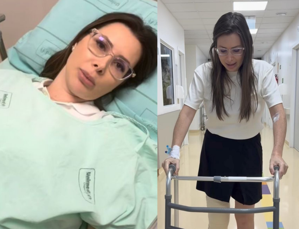 Deputada Caroline de Toni mostra recuperação após ataque de cachorro