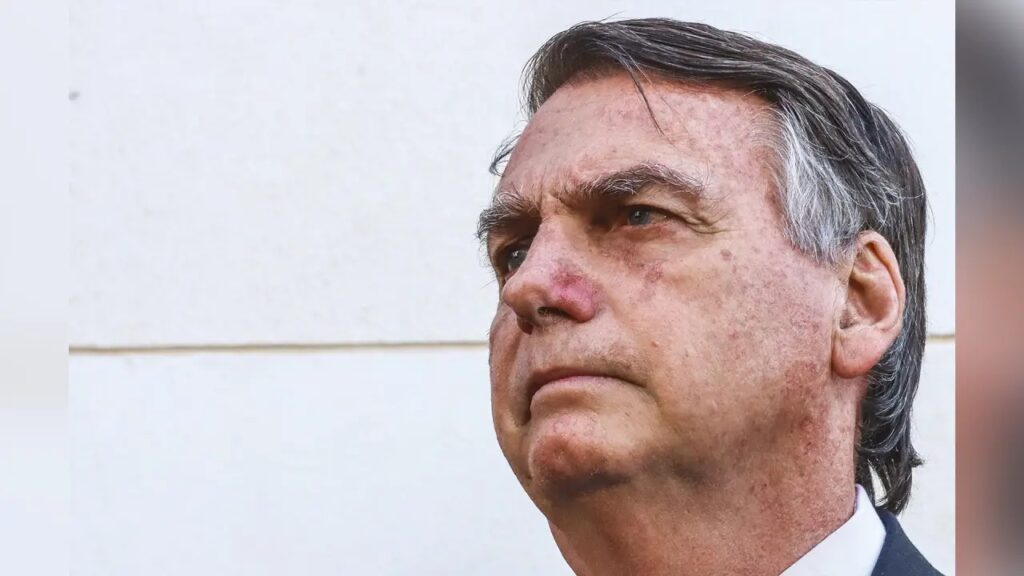 O que é broncopneumonia, diagnóstico apontado em internação de Bolsonaro