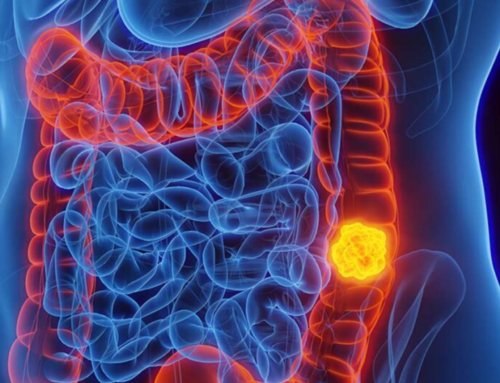 Amesc promove palestra gratuita sobre câncer colorretal