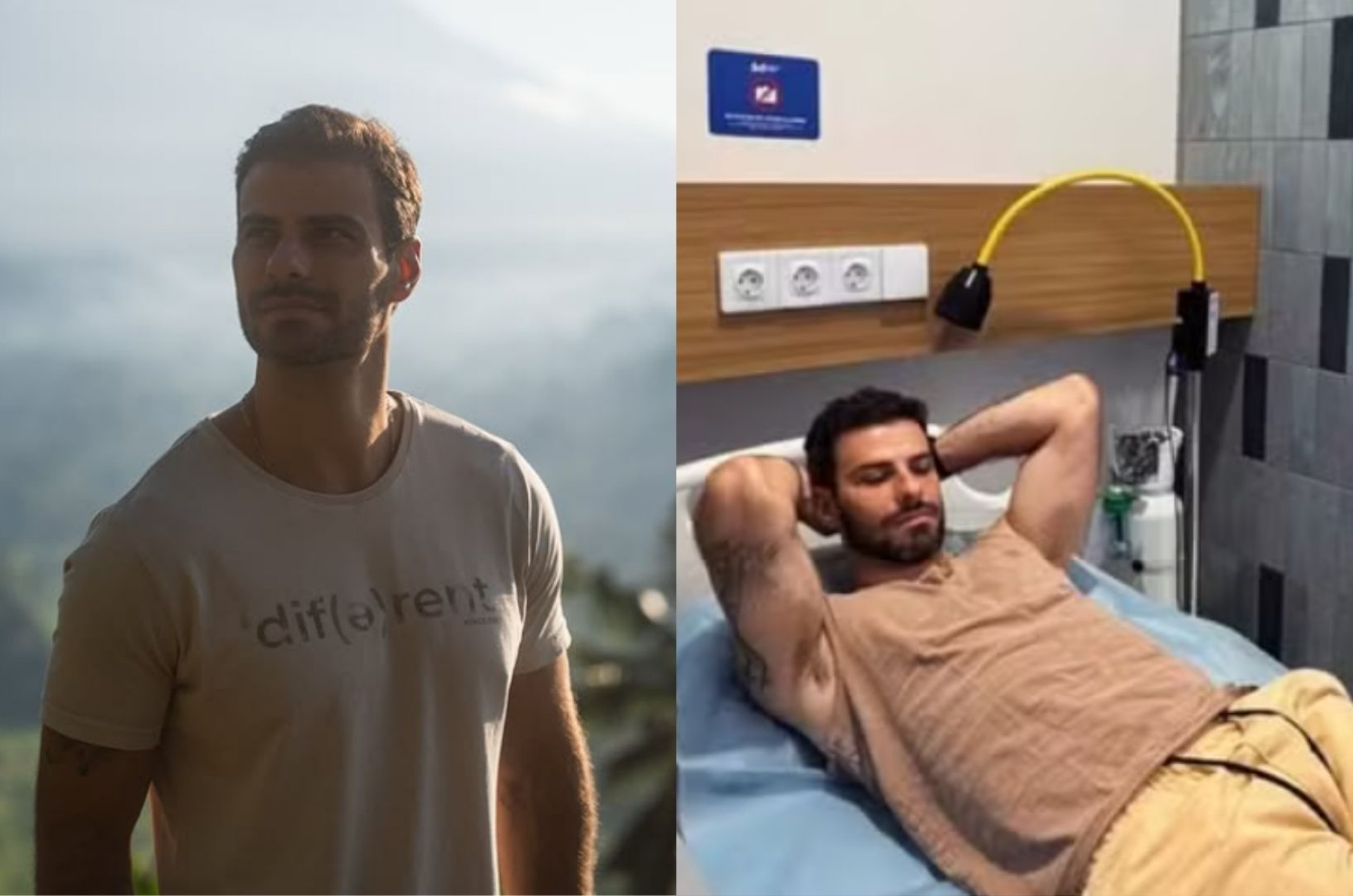 Ator tem reação grave na pele e causa surpreende médicos