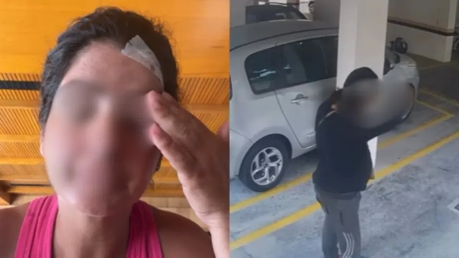 Polícia pede prisão de homem após agressão em condomínio na Capital