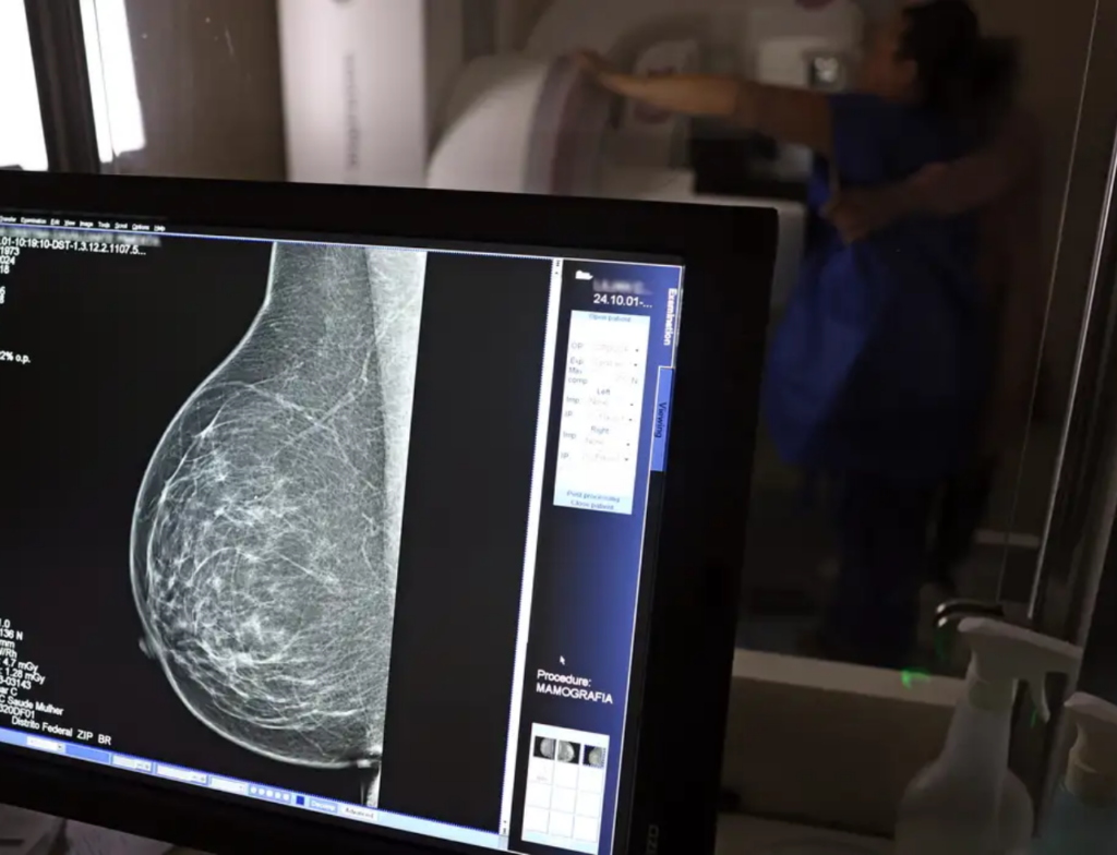 Itajaí reduz fila de mamografias de 7 mil para 187 pacientes - Foto: José Cruz/Agência Brasil